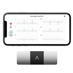 KardiaMobile 6-Lead Personal EKG Monitor